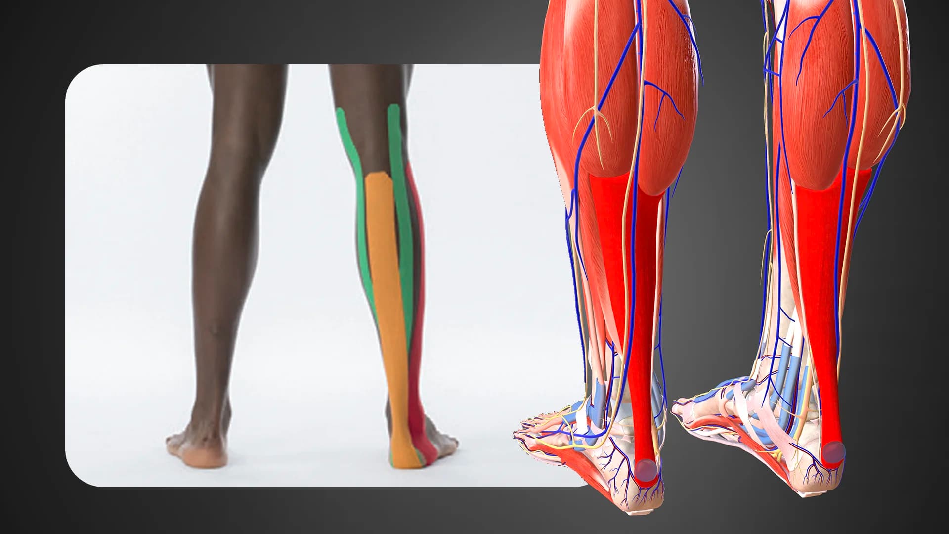 Taping Applicazione Tendine achille