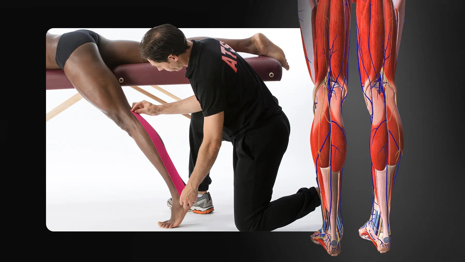 Sclerosi multipla e benefici del Taping Elastico