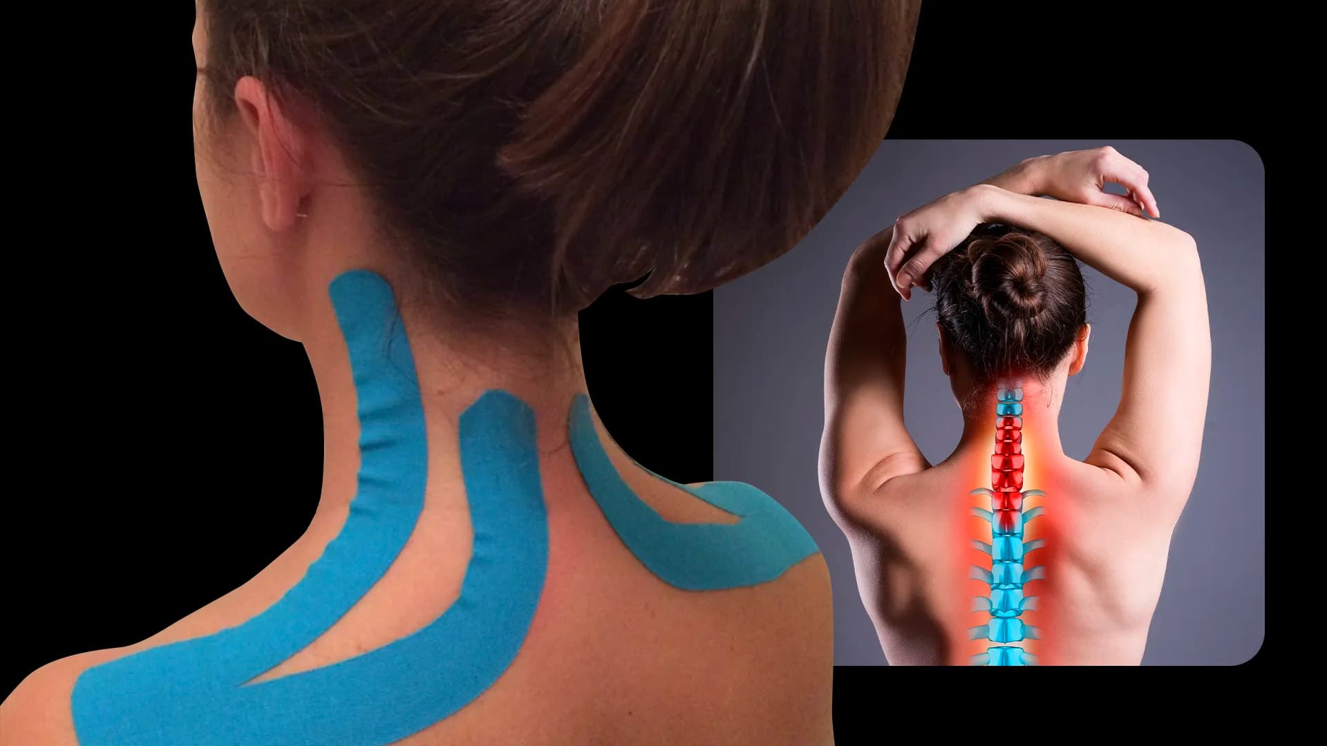 Cervicalgia Applicazione Taping