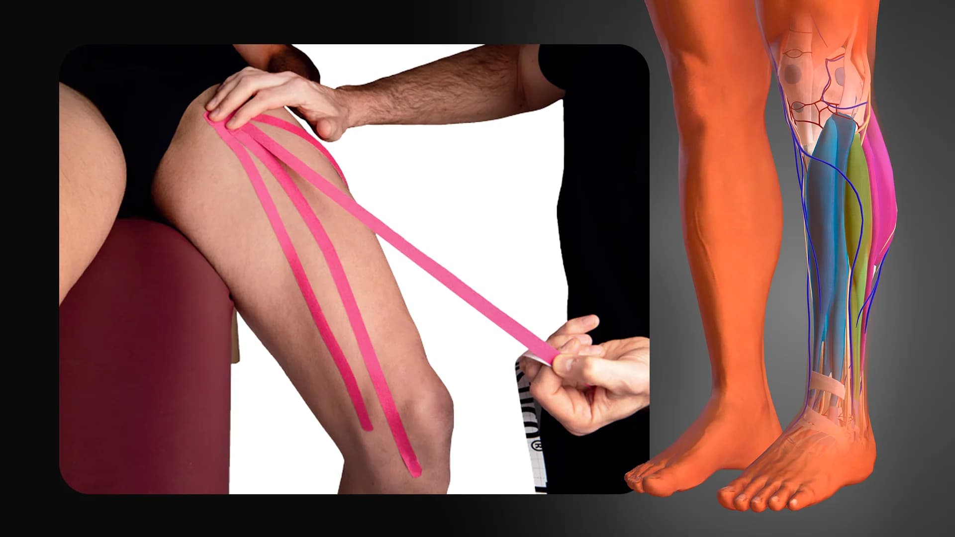 Bendaggio per linfedemi arto inferiore