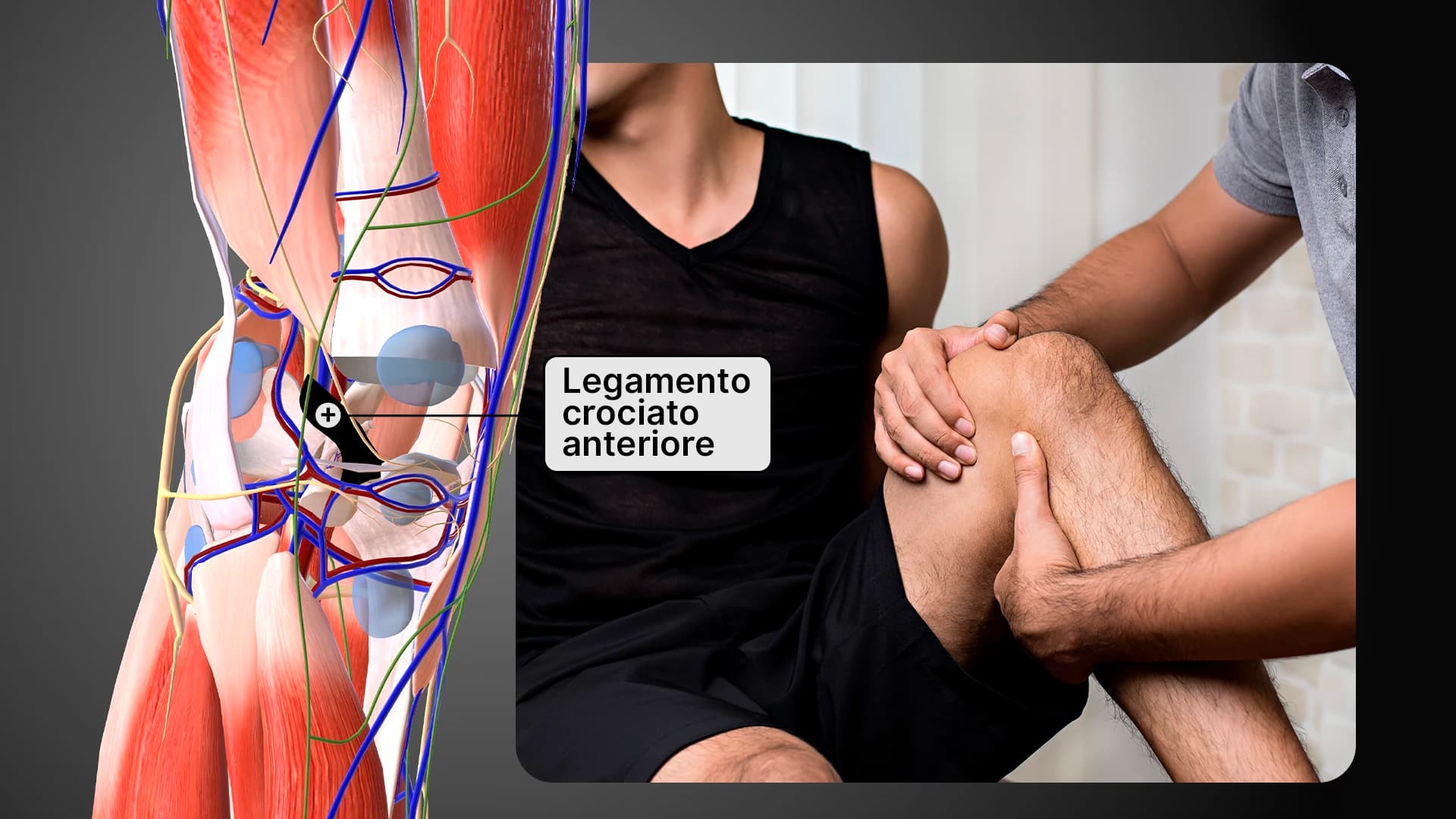Riabilitazione LCA Ginocchio con Bendaggio