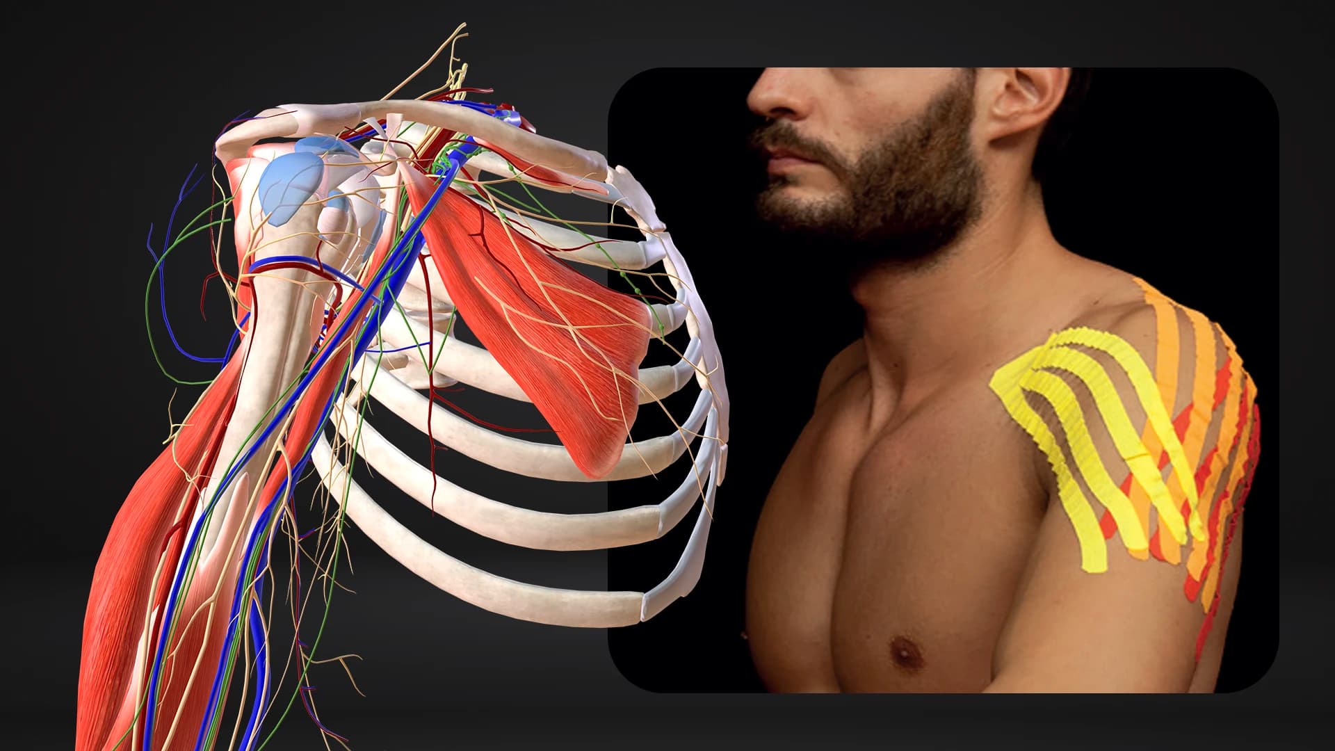 Taping per l’Impingement della Spalla