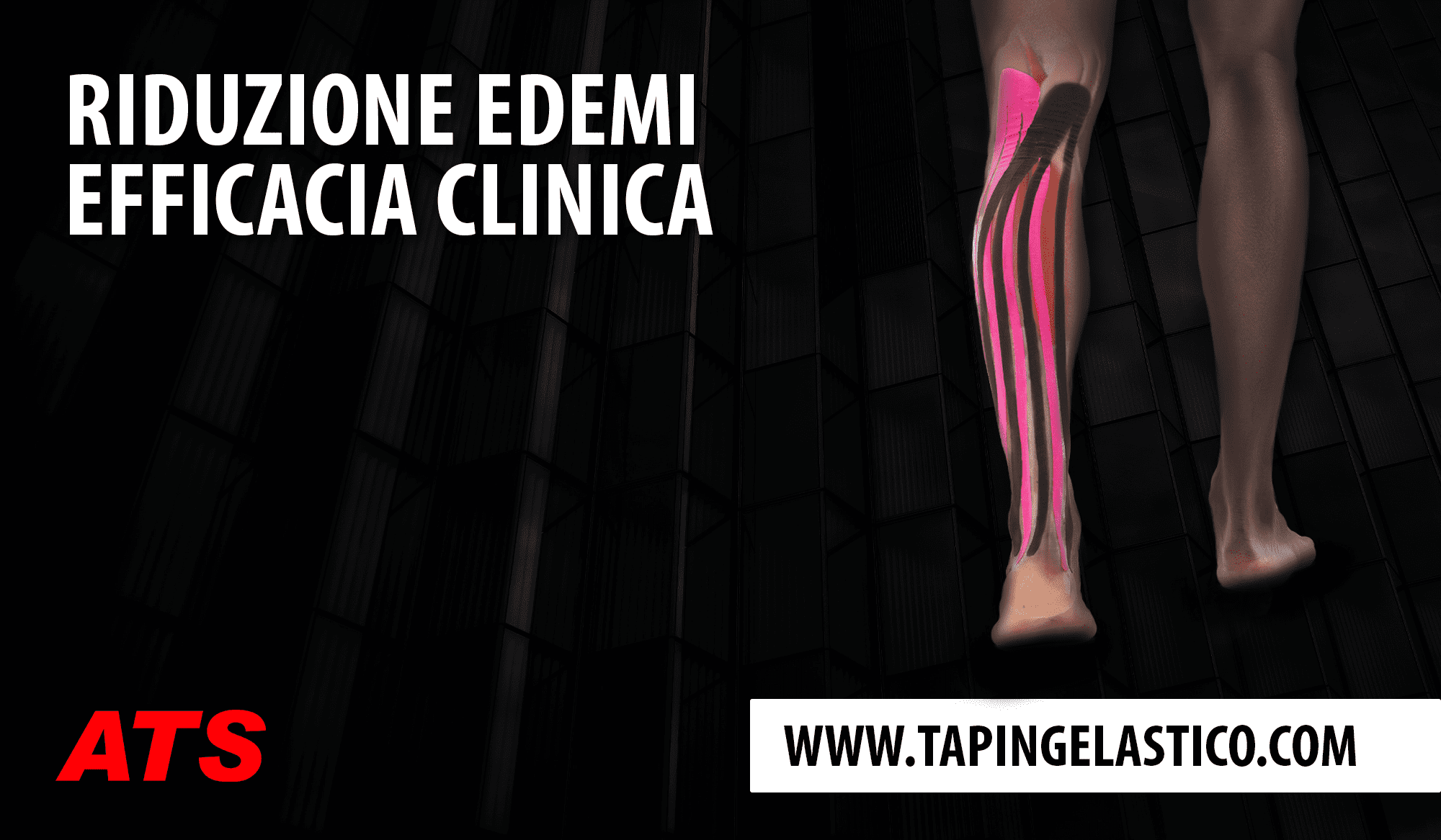 Efficacia clinica dell’utilizzo del Taping Elastico® nella riduzione degli edemi agli arti inferiori. Applicazione Linfodrenante.