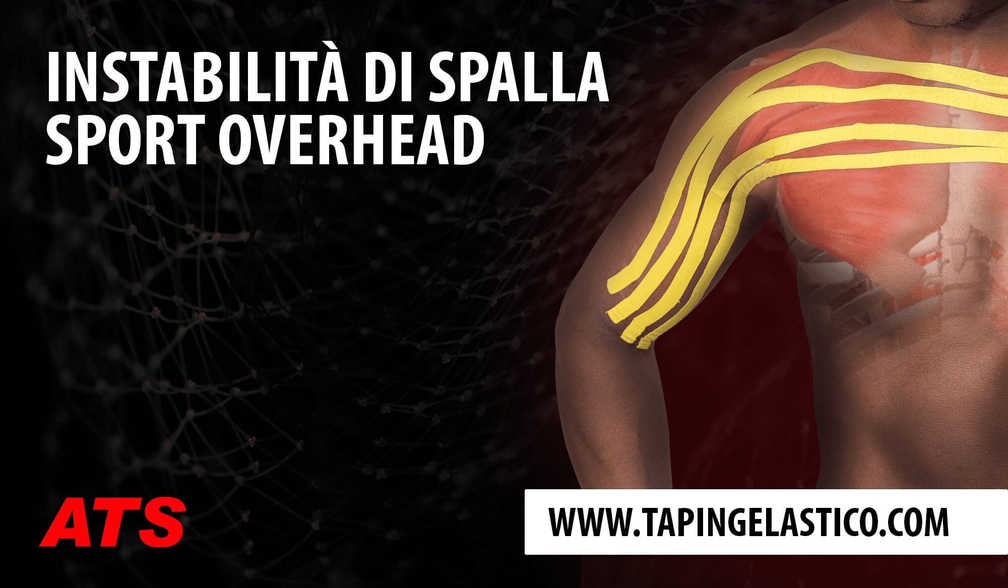 Instabilità di spalla negli Sport Overhead e Taping Elastico®